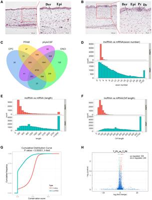 Transcriptome Reveals Long Non-coding RNAs and mRNAs Involved in Primary Wool Follicle Induction in Carpet Sheep Fetal Skin